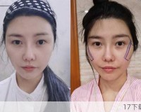 人造美女大比拼，谁能超越棒子国的审美巅峰？揭秘韩国最强童颜女星背后的秘密